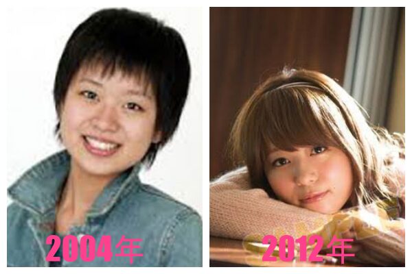 井口裕香の顔が変わった？整形疑惑の真相と劇的変化の理由を徹底検証