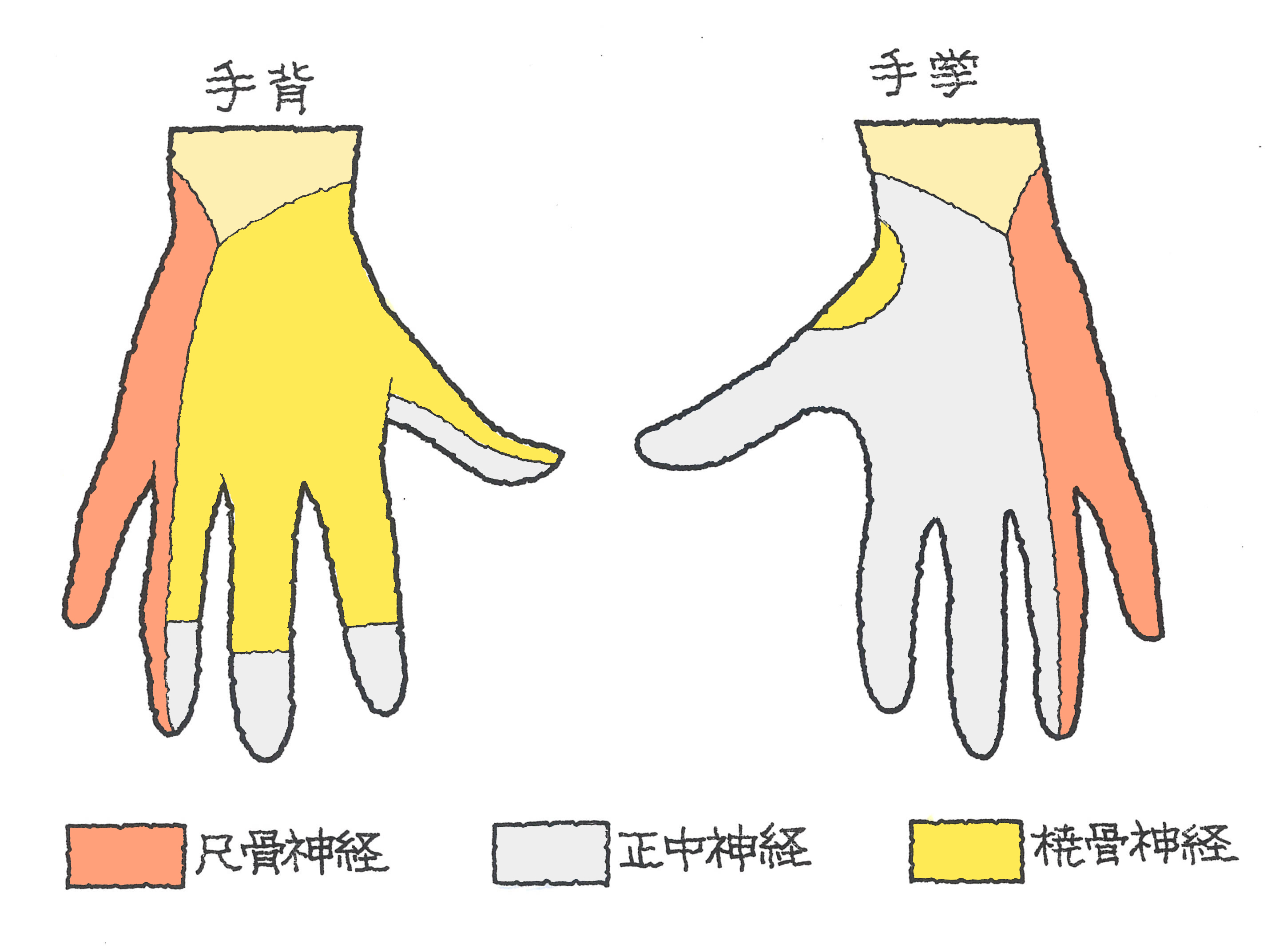 朝起きて手が動かない？橈骨神経麻痺の原因と治し方を徹底解説
