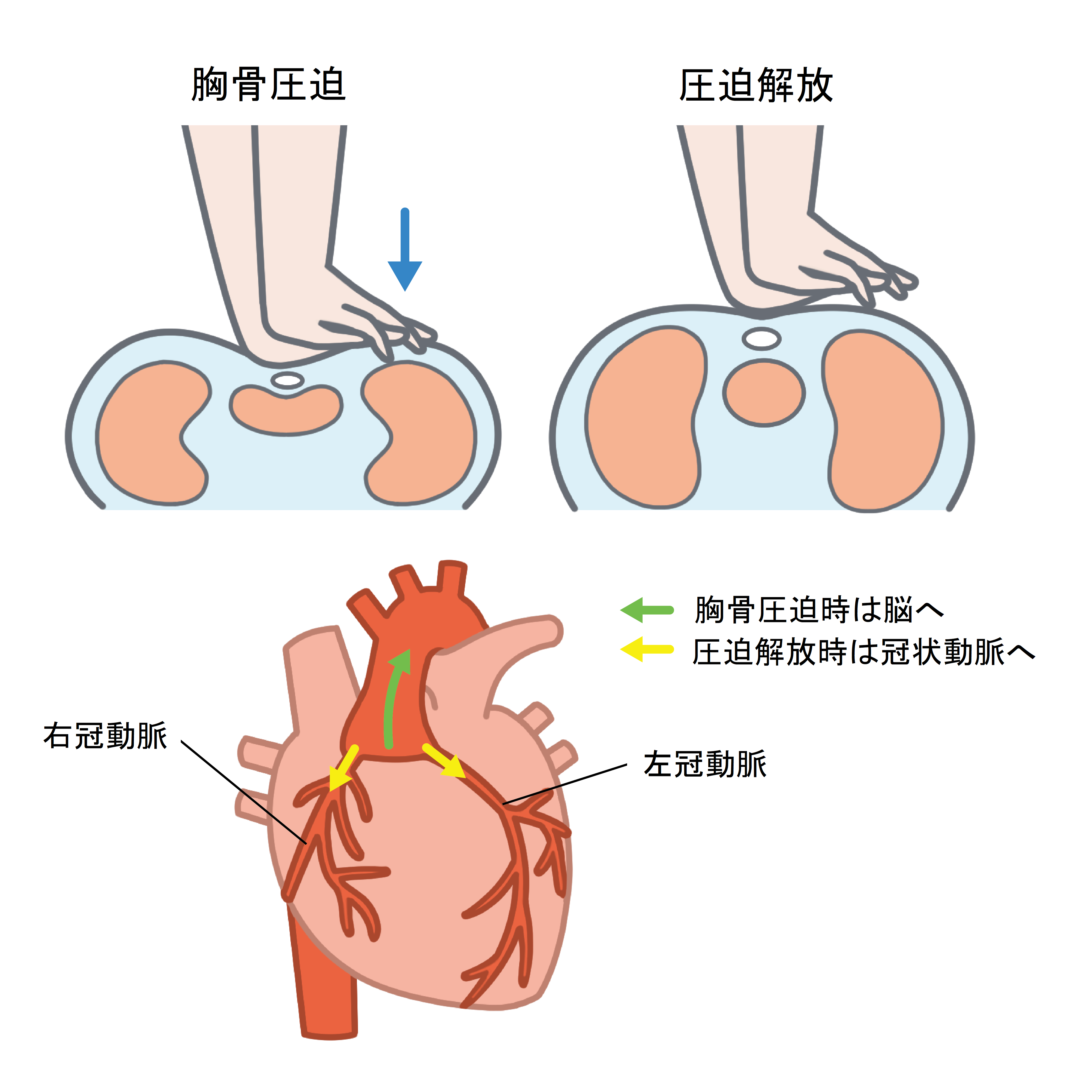 心肺停止と死亡の違いとは？ニュースでそう報じる理由と蘇生の可能性