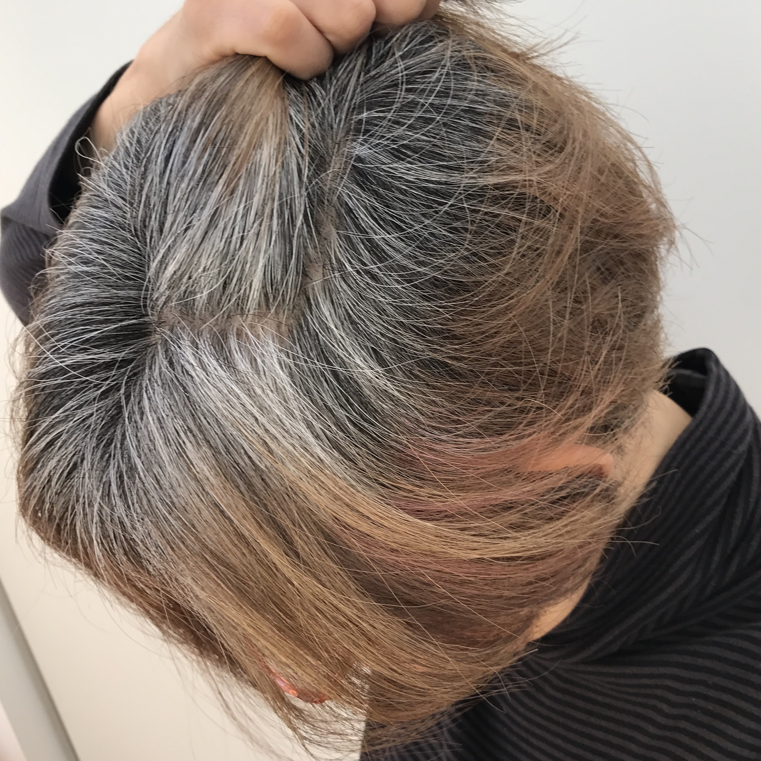 下の毛に白髪が生える原因とは？抜くリスクと2026年最新の対処法