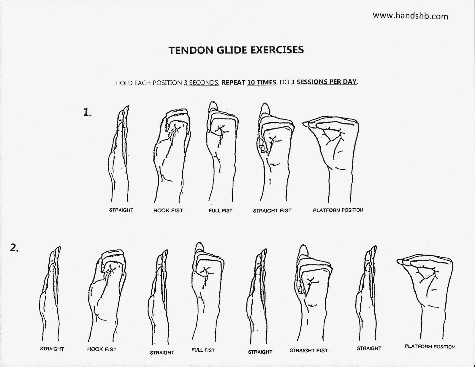 Tendon Gliding Exercises for Trigger Finger
