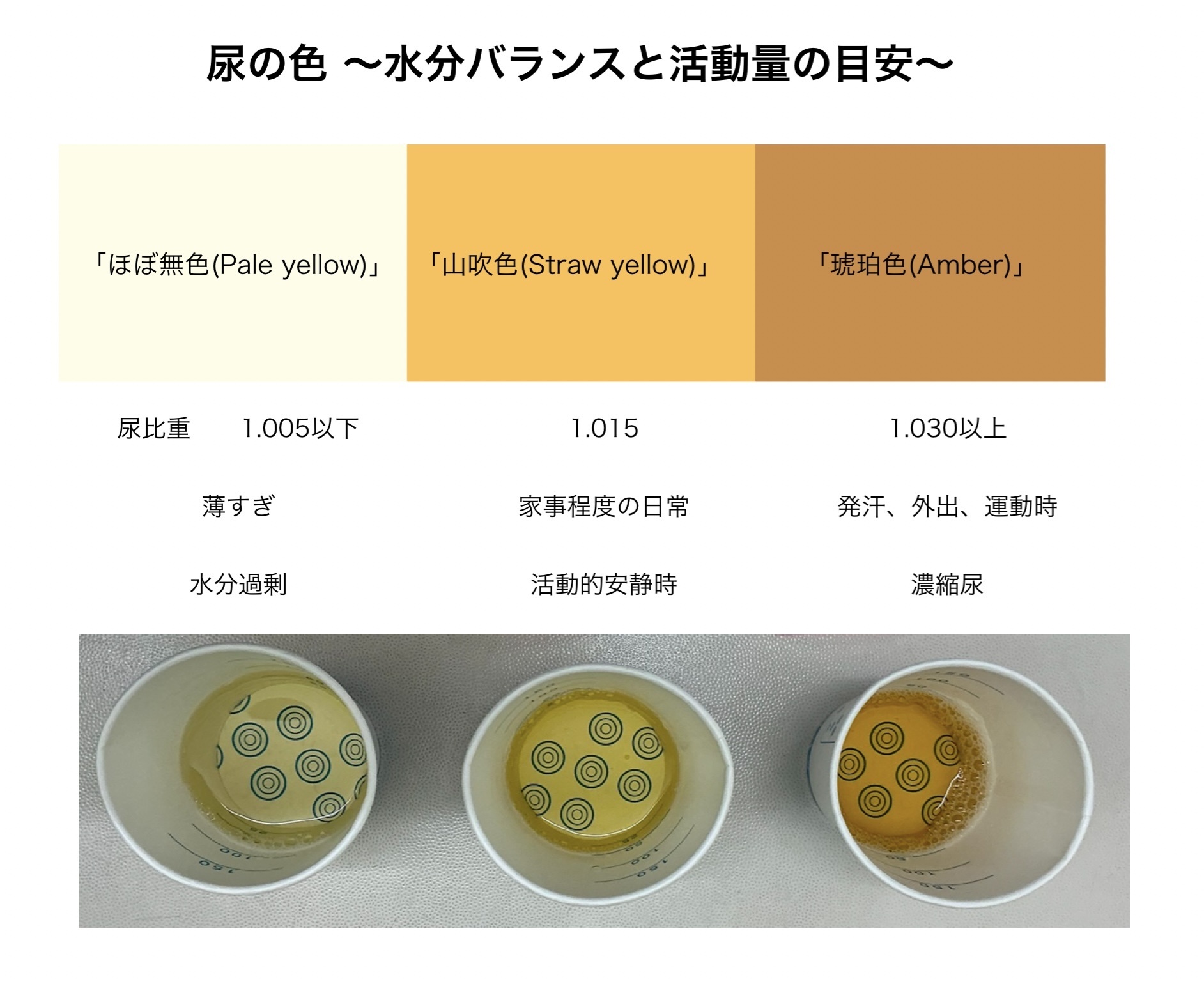 尿の色でわかる危険な病気サイン！放置厳禁の異変と受診目安を解説