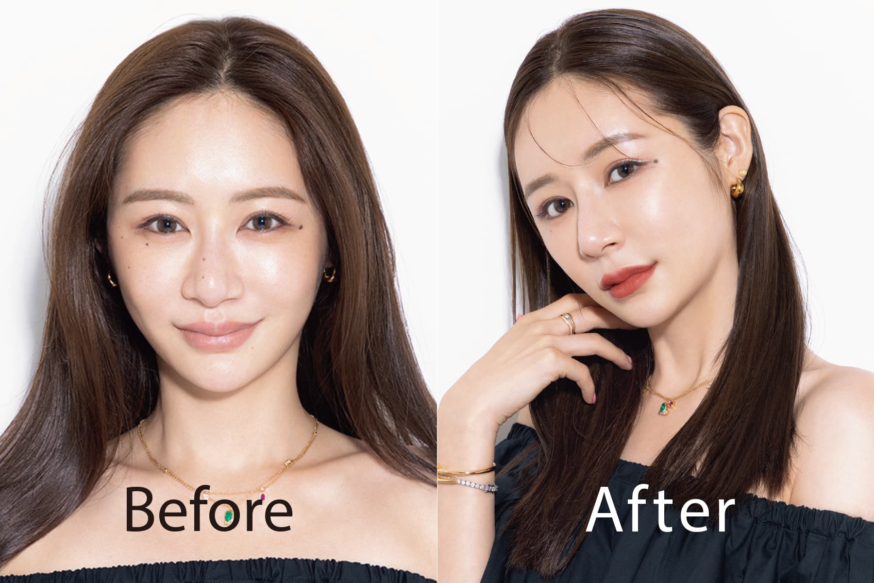宮崎麗香の整形疑惑を徹底検証！昔と現在の顔変化と美容医療の真相