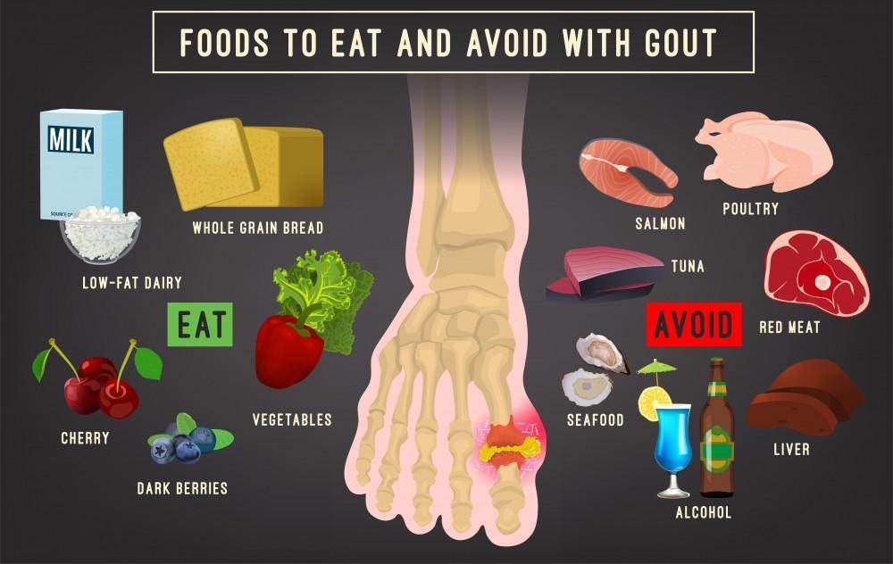 What Foods Can You Not Eat When You Have Gout