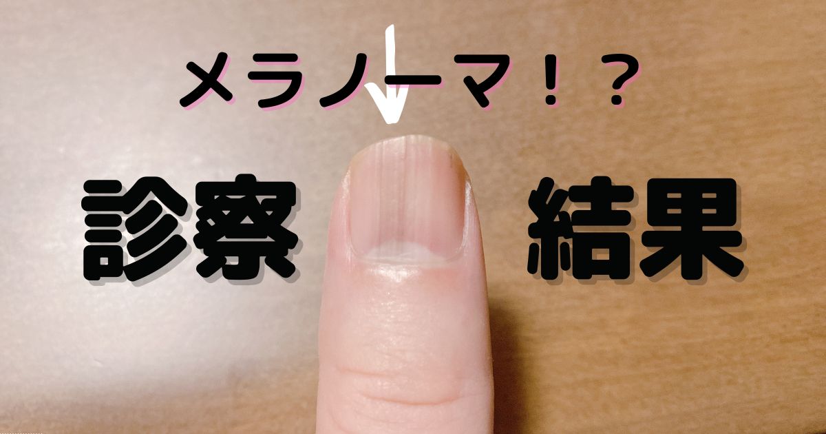 佐賀・みやきの名水が愛される理由と水汲み場の料金・水質を徹底検証