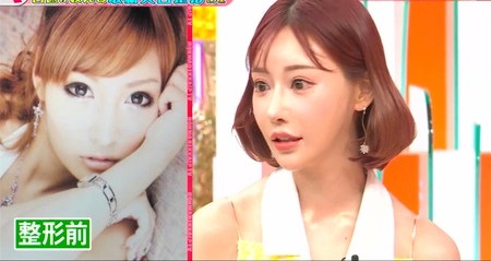 【噂】 明日 花 キララ 整形 最新出演情報まとめ #678