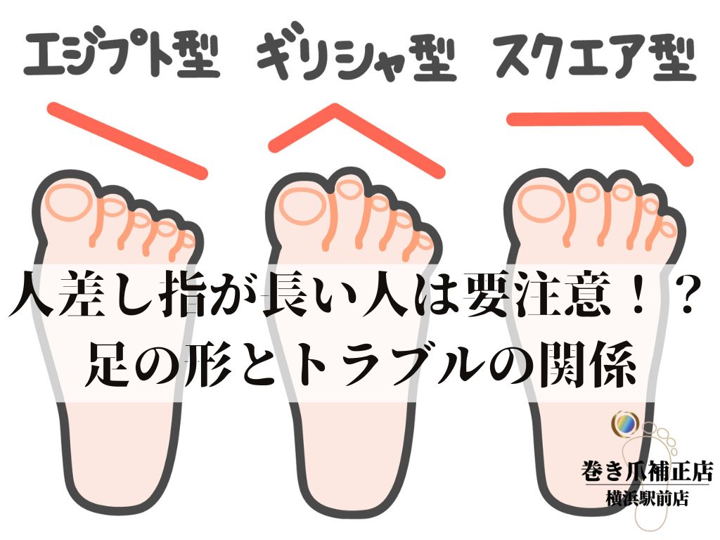 足の人差し指が長い理由と迷信の真相｜ギリシャ型の特徴と靴選び