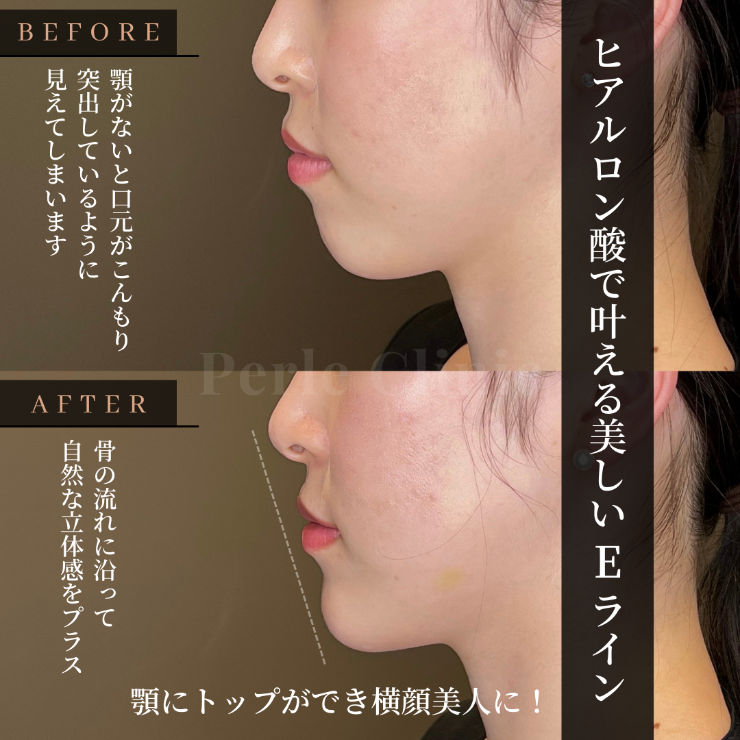 「Eラインじゃない美人」の真実！横顔の黄金比を超えた魅力の秘密