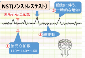【プロフィール】 ノン ストレス と は 話題のSns投稿まとめ 2026 #931