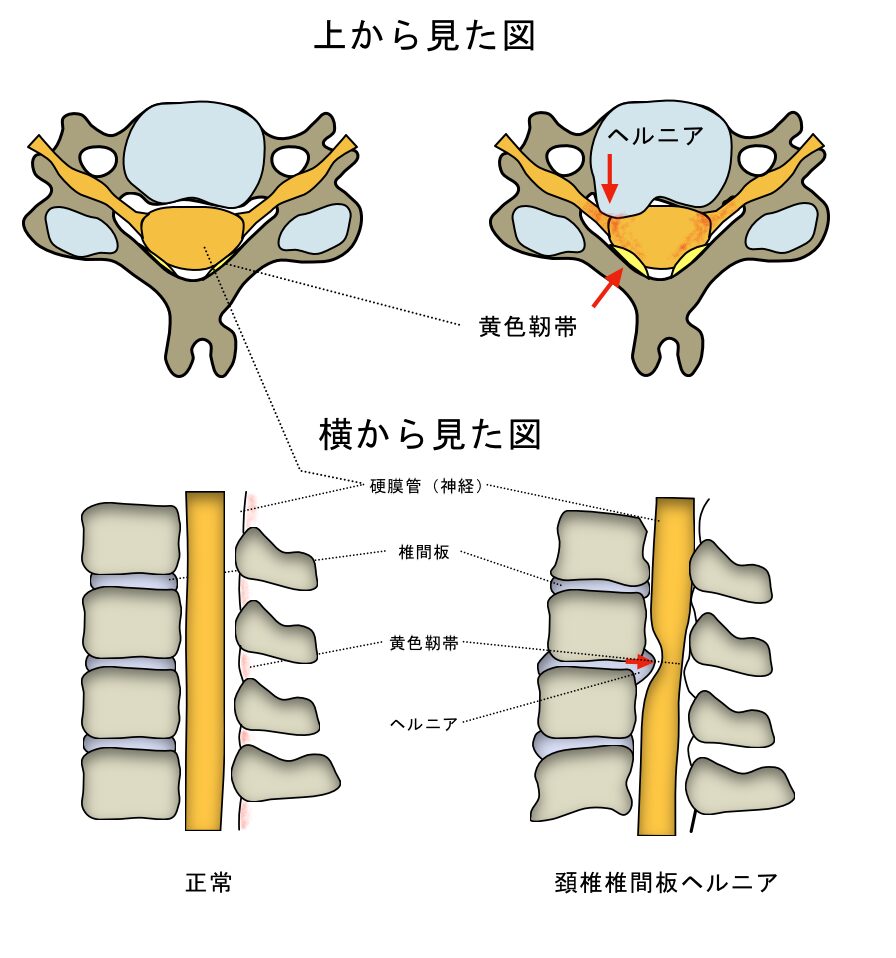 首が痛い時は何科？病院の選び方と放置厳禁の危険なサイン【2026】