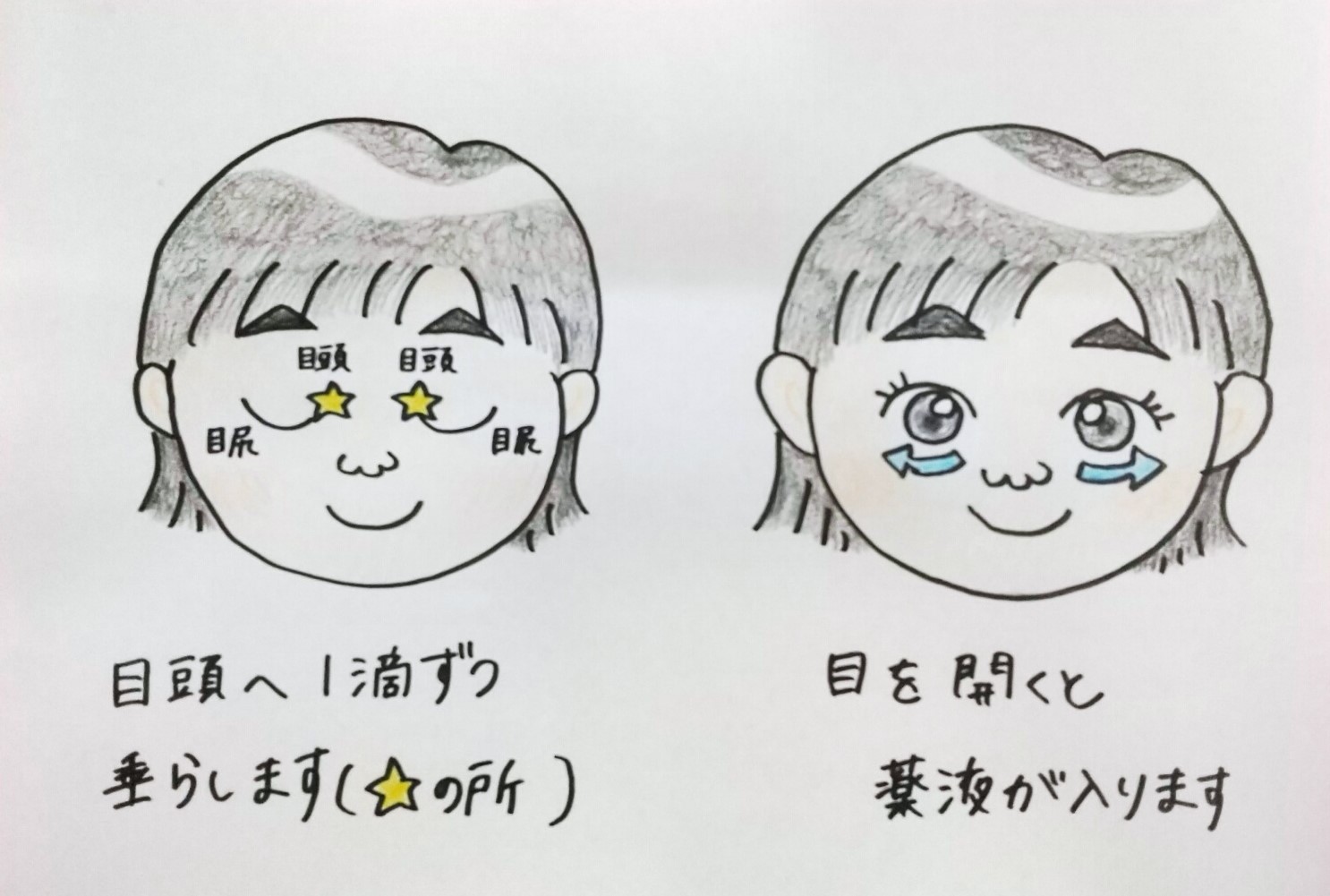 目薬が苦手でも一発命中！眼科医推奨の簡単な差し方と溢れない裏ワザ