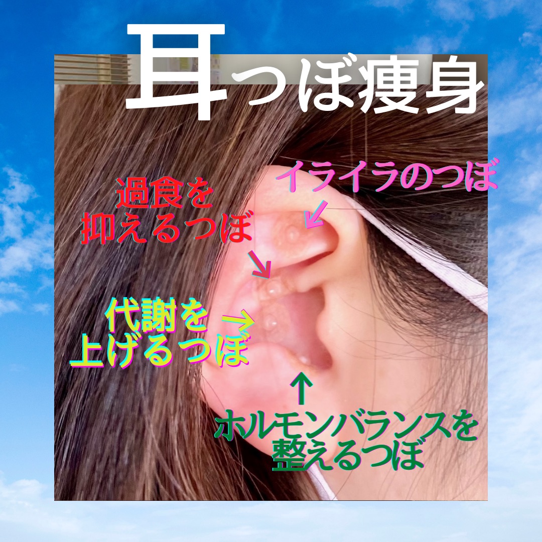 耳つぼダイエットは痩せない？効果の真実と正しい位置・費用を徹底検証