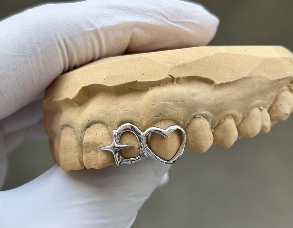 口元を飾るグリルズとは？値段相場や作り方・歯の危険性まで徹底解説