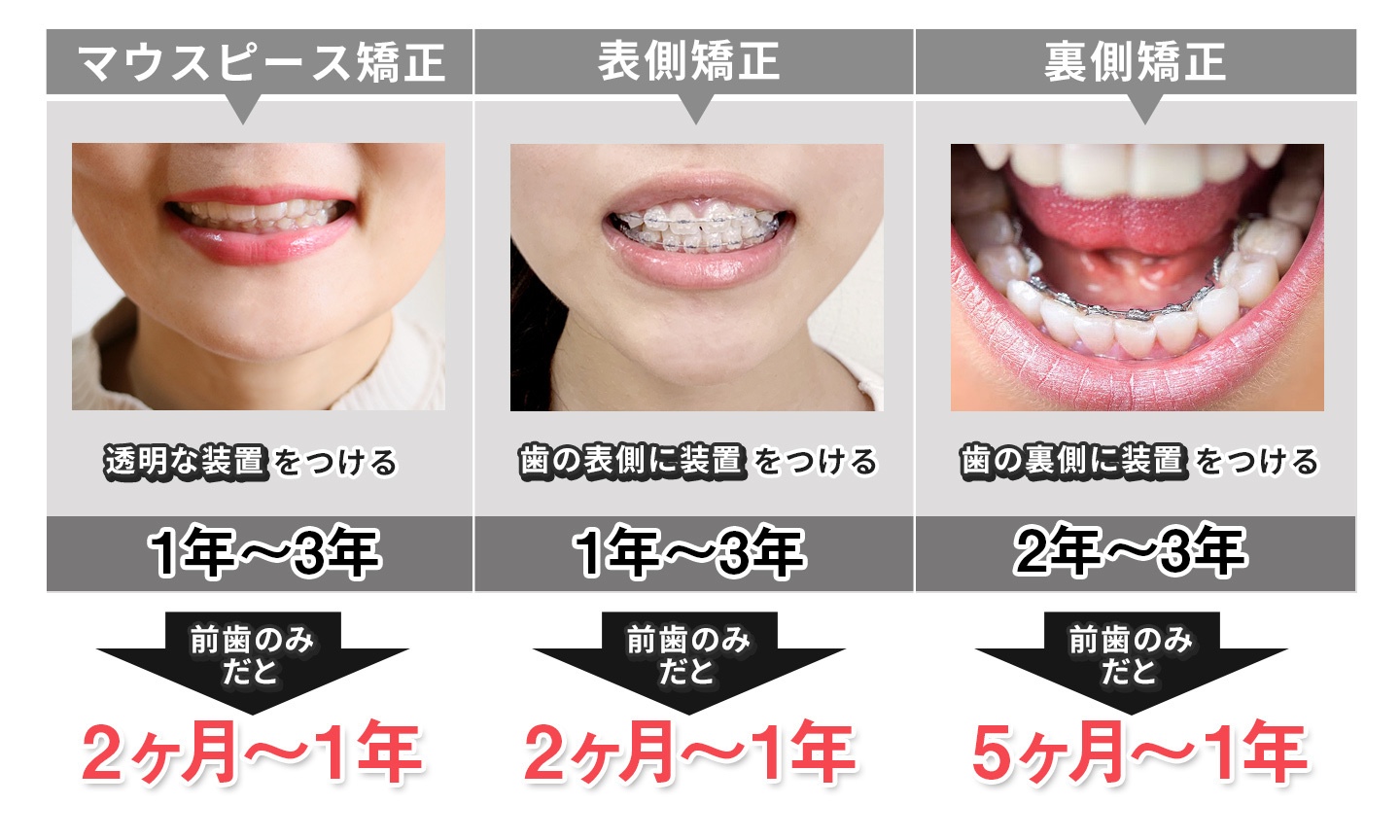 マウスピースで顔が変わる真相は？輪郭・エラ・頬こけの原因と後悔防止策