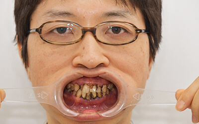 【プロフィール】 歯 が ボロボロ 芸能人 最新写真集＆動画まとめ #686