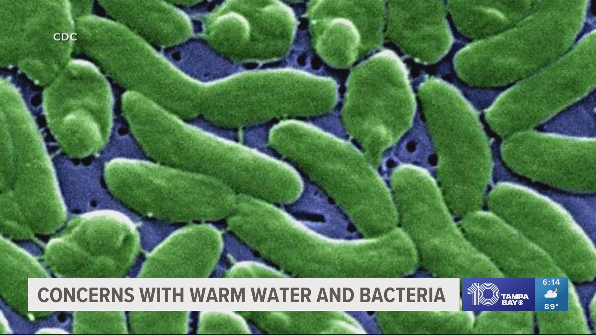 Does Hot Water Kills Bacteria