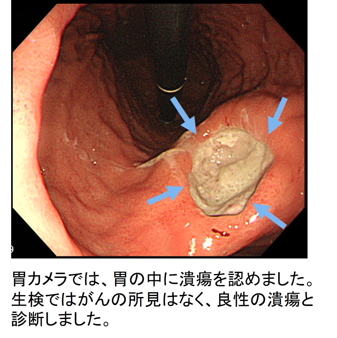 胃が痛い時は何科を受診？内科と消化器内科の違いや危険サインを解説