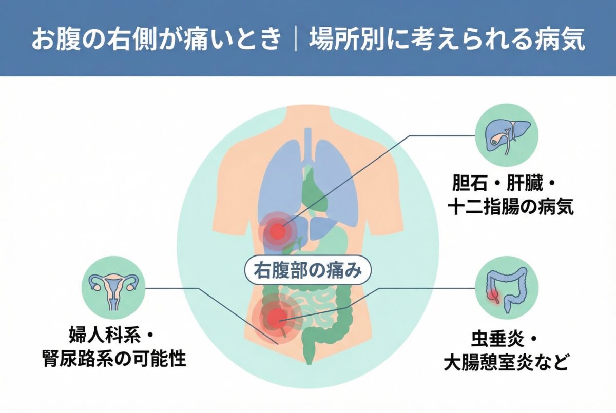 お腹の右側が痛い原因を徹底解説！盲腸・胆石の見分け方と受診目安
