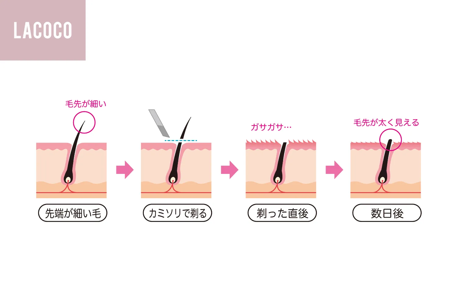 毛を剃ると濃くなる噂は嘘？皮膚科医が明かす錯覚の正体と正しい対処法