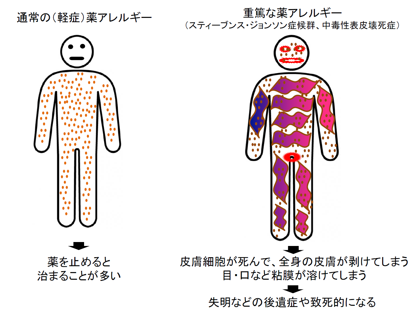 風邪薬を飲んで発疹やかゆみ？見逃せない初期症状と危険な副作用