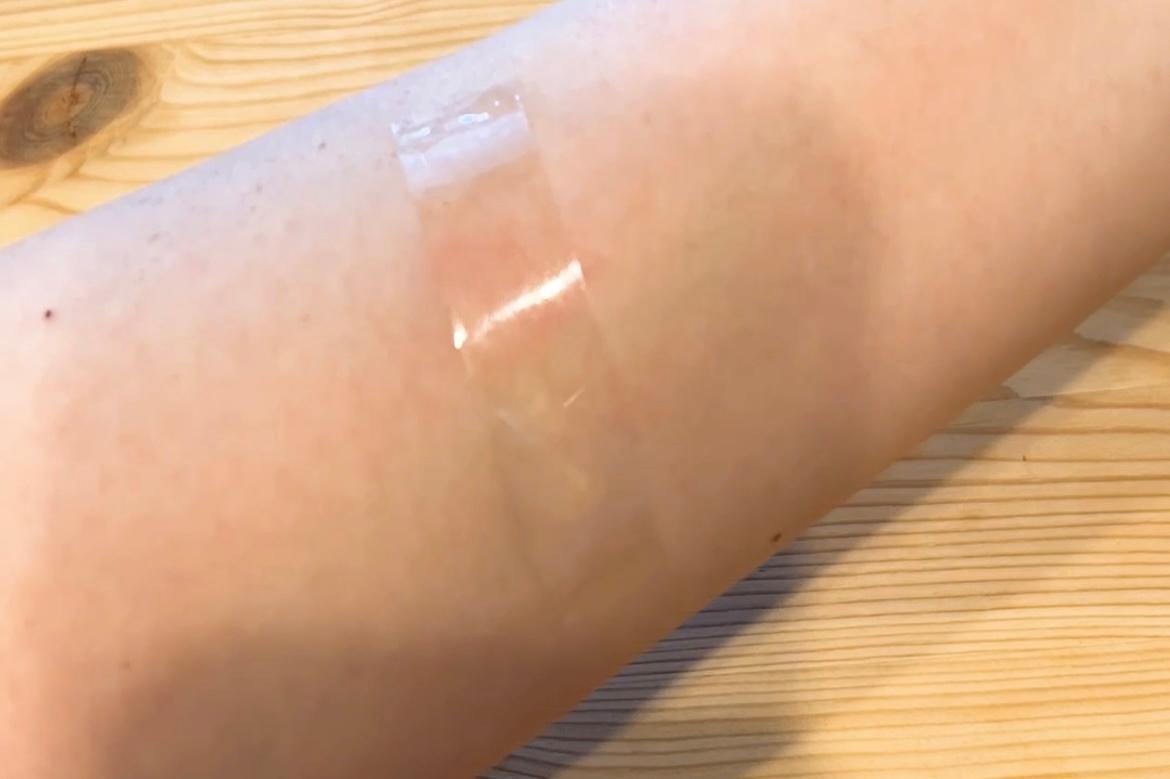 蚊に刺されたらセロテープは危険？痒みが消える噂の真相と皮膚科医の見解