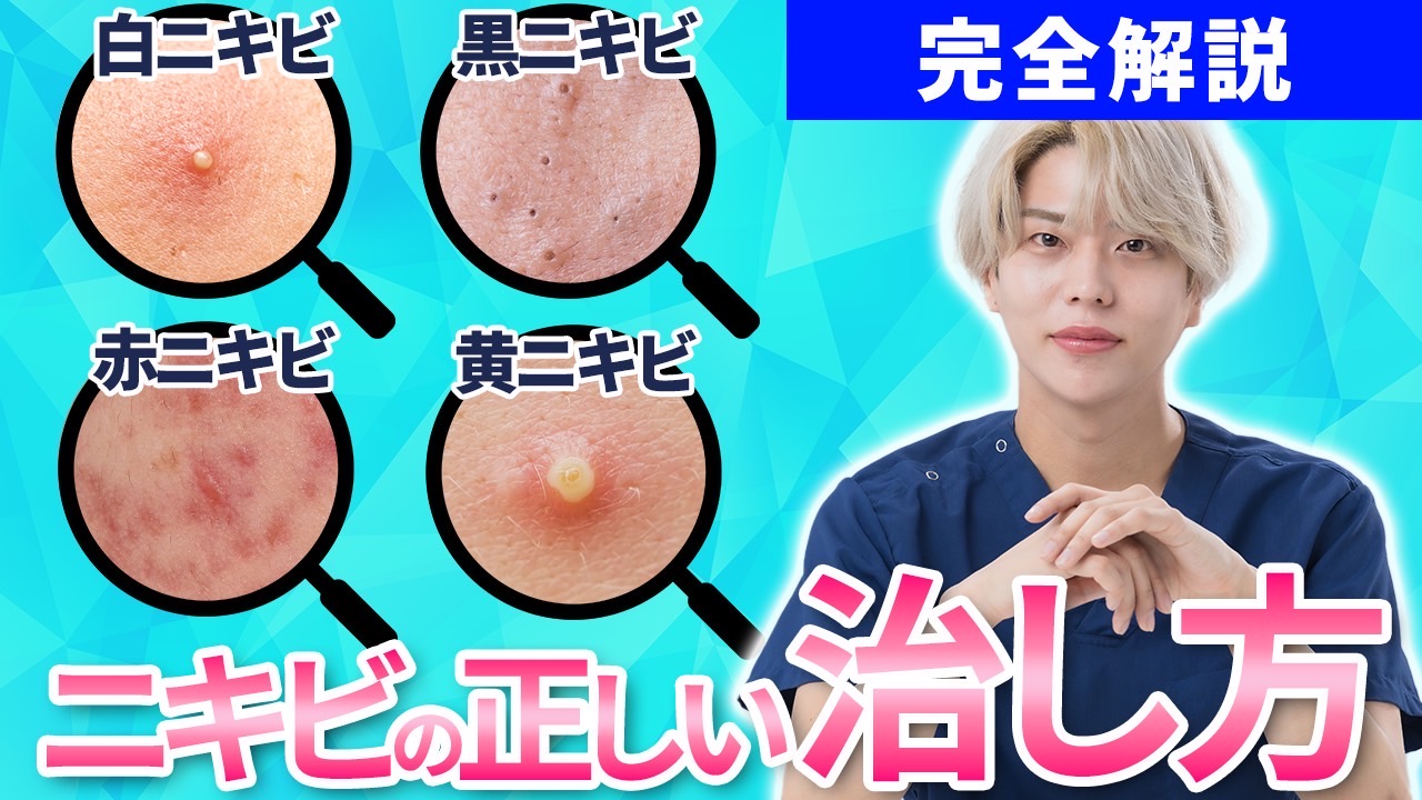【2026年最新】皮膚科医が教えるニキビの正しい治し方と最短ケア
