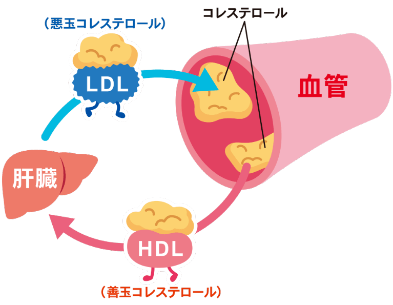 コレステロール値の新基準と噂の真相！健康診断の見方と年代別の目安