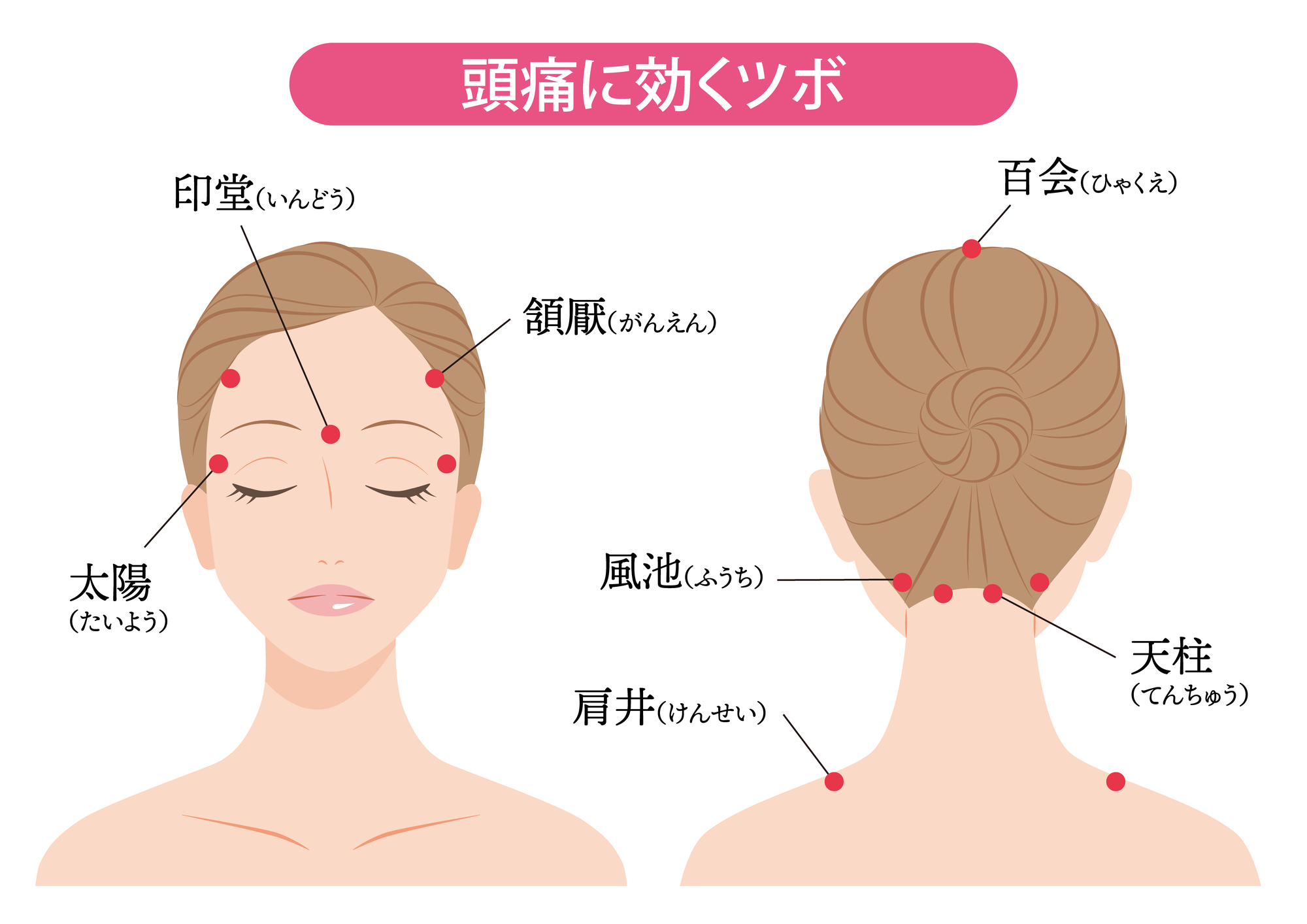 偏頭痛に即効で効くツボは？手の合谷や風池の押し方とNgな注意点
