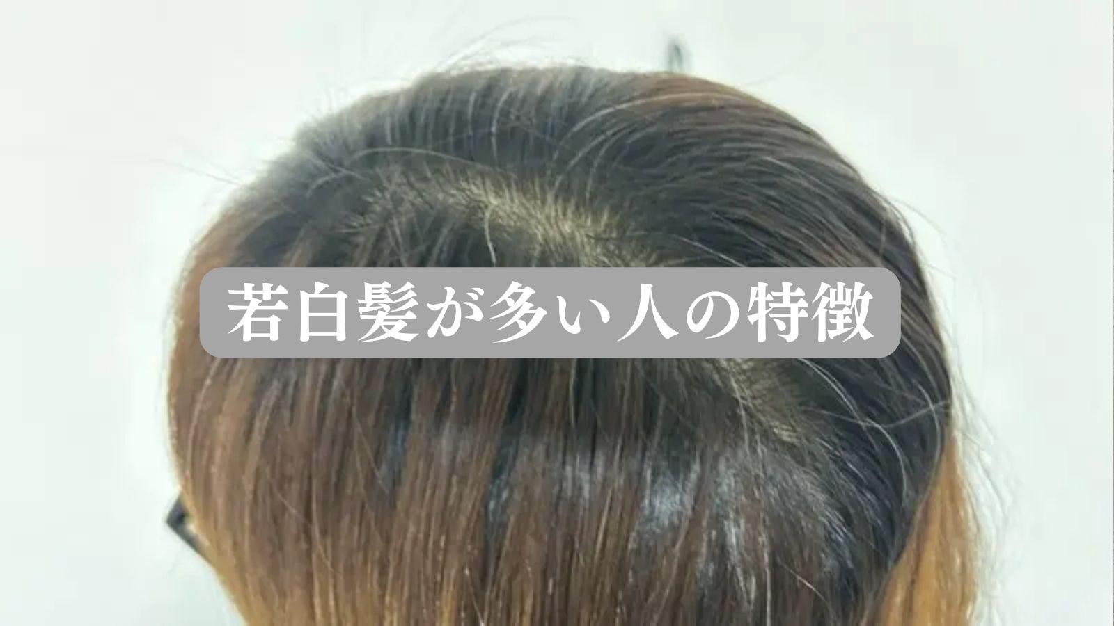 若白髪が多い人の特徴と共通点｜生える場所のサインと改善策を徹底検証